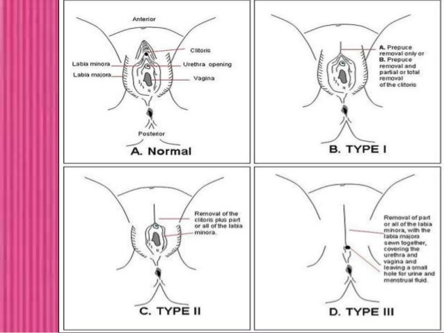 sizes of vulva of women Busty bbw vids